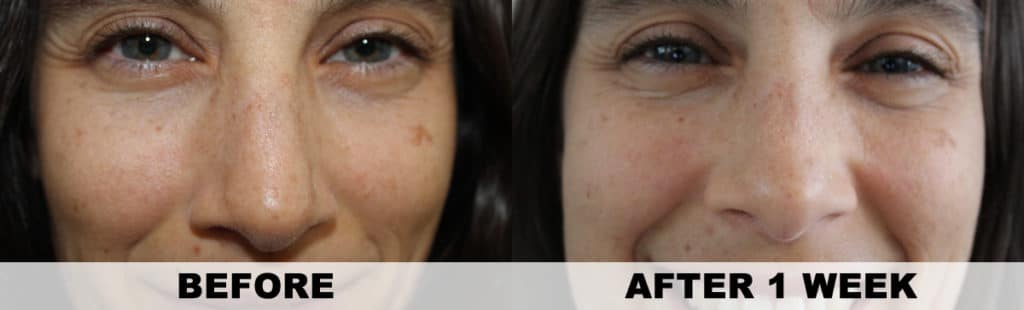 Annmarie Gianni Review - Before & After